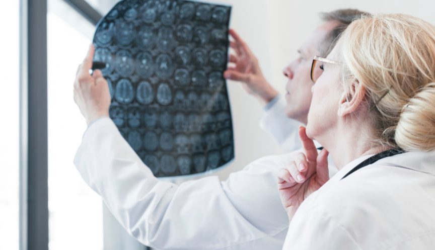 Заболевания нервной системы